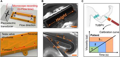 A bio-fabricated tesla valves and ultrasound waves-powered blood plasma viscometer